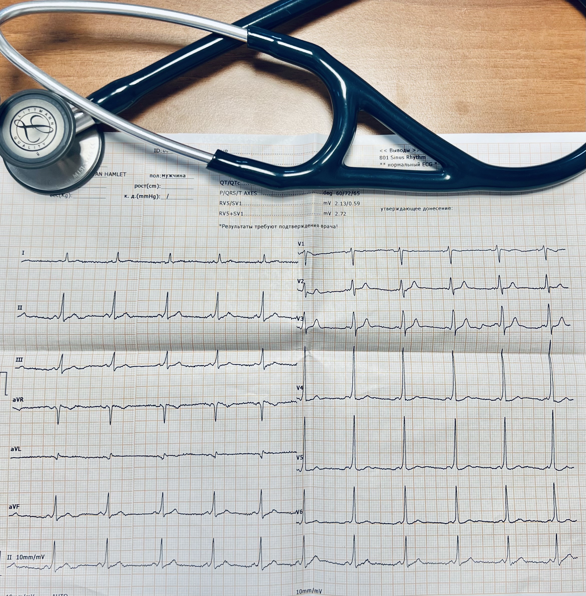 ԷՍԳ այբուբենը